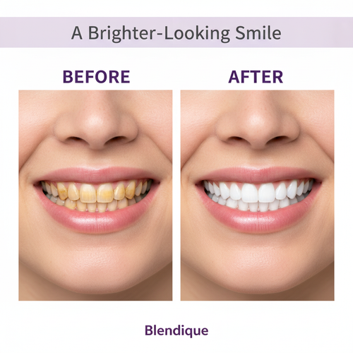 Whitening Strips