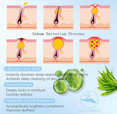 Pimple relief