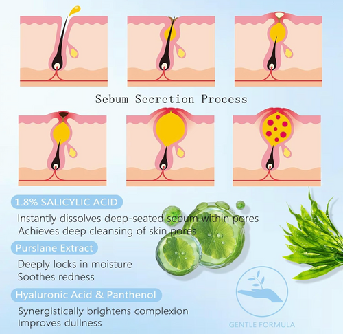 Pimple relief
