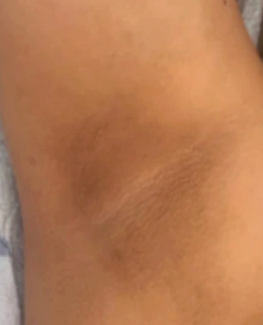 After